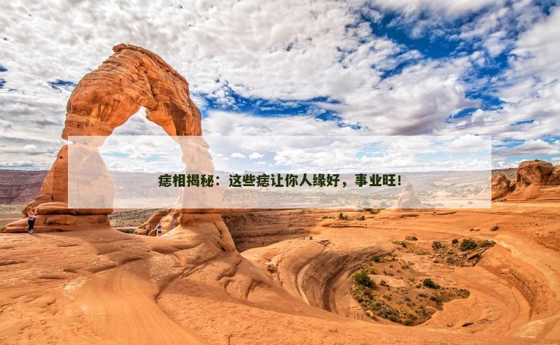 痣相揭秘：这些痣让你人缘好，事业旺！