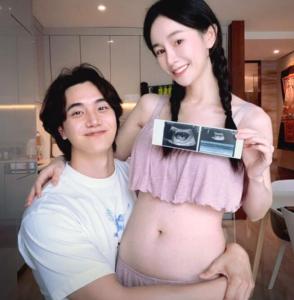张檬自曝孕35周臀位绕颈 张檬老公是谁？